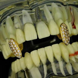 【送料無料】ジュエリー・アクセサリー ゴールドメッキファンググリルセットアイスヴァンパイアヒップホップグリル18k gold plated fang grillz set iced cz teeth vampire hip hop mouth grills