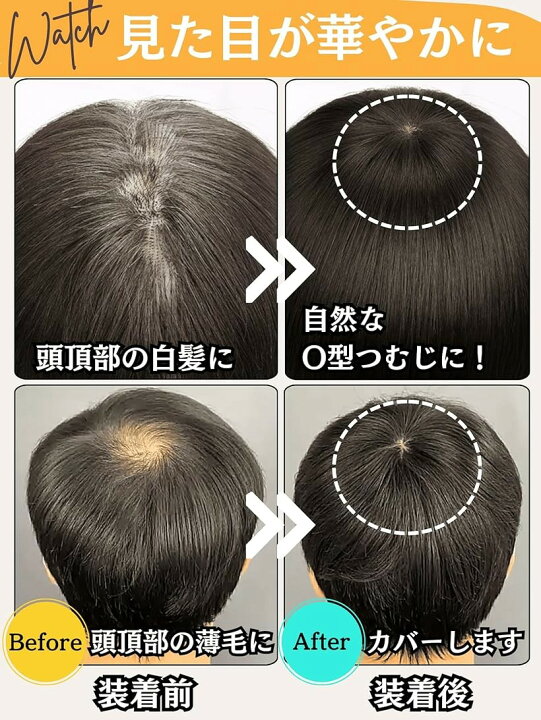 楽天市場】ヘアピース 人毛 部分ウィッグ かつら 男性 女性 カツラ 