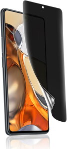 1������Xiaomi 14T / Pro �p�`�����h�~ �t�B���� ��p ��K���X TPU�f�� �w��F�؂��\ ���˖h�~ �����h�~ �C�A���X �L�Y�C�� 3D�ی� �t���ی�t�B���� (TMK-UCI-261)