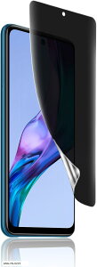 1ZbgRedmi Note 10T / JE p `h~tB wFؑΉ _炩TPUf Ch~m[g Note10JE Note10T XIG02 h~ ߗ(COL-494)