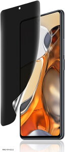 1���Z�b�gXiaomi 11T / Pro �p �`�����h�~�t�B���� �w��F�ؑΉ� �_�炩��TPU�f�� �����C��Xiaomi 3D�Ȗʕی�K���X�t�B�����C���X�g�[���c�[���t���\��t���ȒP �����h�~ �����ߗ� �_� (COL-497)