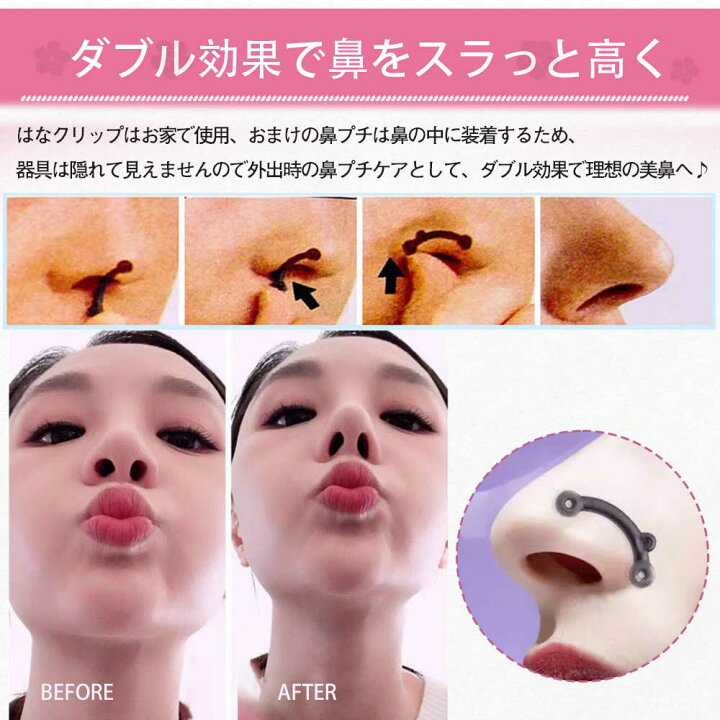 楽天市場】ノーズクリップ 小鼻 ノーズアップ 2点セット 鼻クリップ 