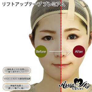 y  zAVXg tgAbve[v v~A 3m RXvpe[sO RXvCN RX Assist