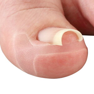 yzTCvX ܃e[v ~G[k 10 TPY ^v[g tB d\ ڗȂ ɓ ܂Â߃PA ܂̈K[h FFNAATCYF20×55mm