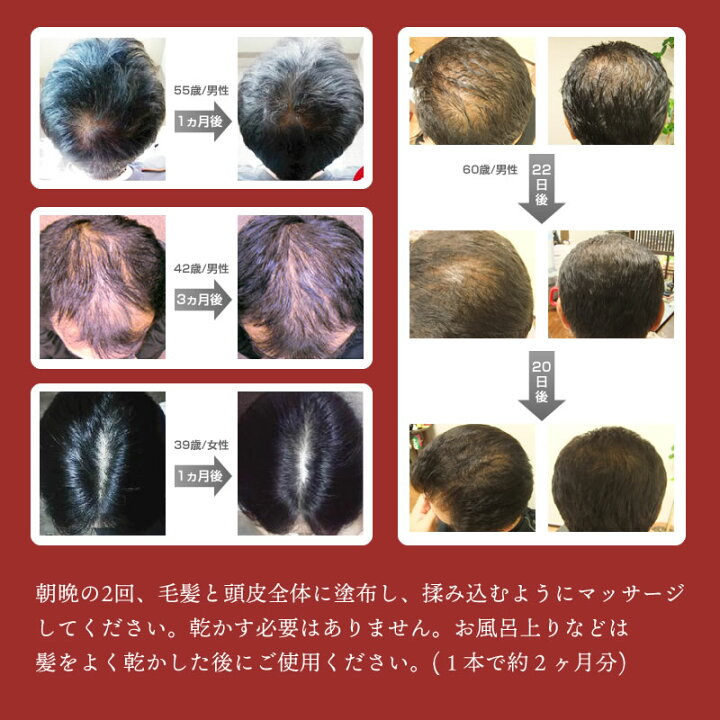楽天市場】【育毛、スカルプケア】リモウ・スカルプローション (みどり 