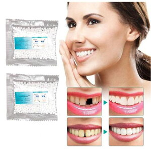 �t�B�b�e�B���O�r�[�Y���ȗp���W���Y�M���r�[�Y�̎����ڒ��܋U�̎��㕔�������x�j�A���ꎕ�P�A�p�i�ꎞ�I�Ȏ��̏C���L�b�g�������������}���u�������������C�������������̏㕔�Ɓc