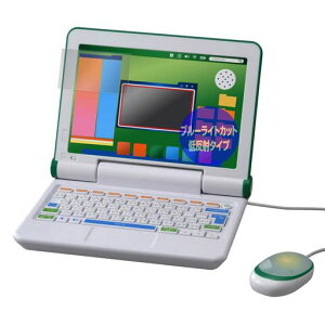 ~rbNX}EX!wق̐}NEOp\Rpu[CgJbgᔽ˖ڂɗDیtB{OverLayPlusEyeProtector