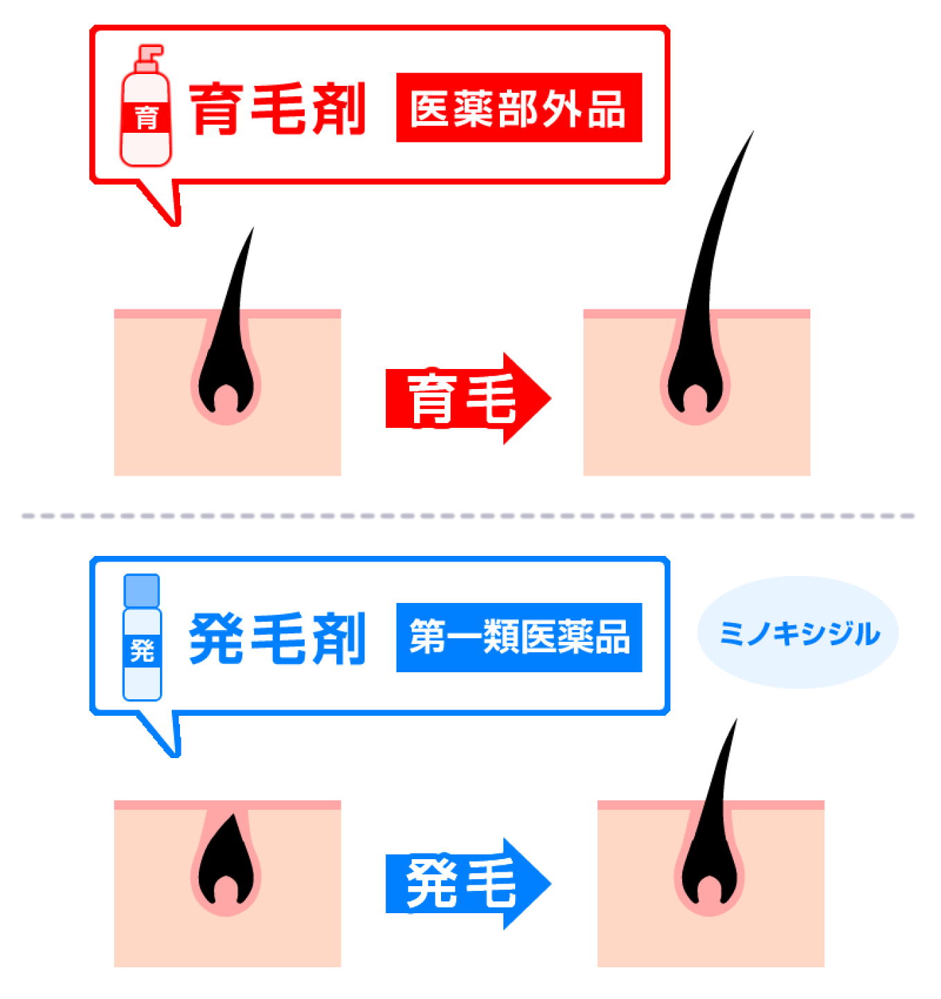 育毛 発 毛 違い