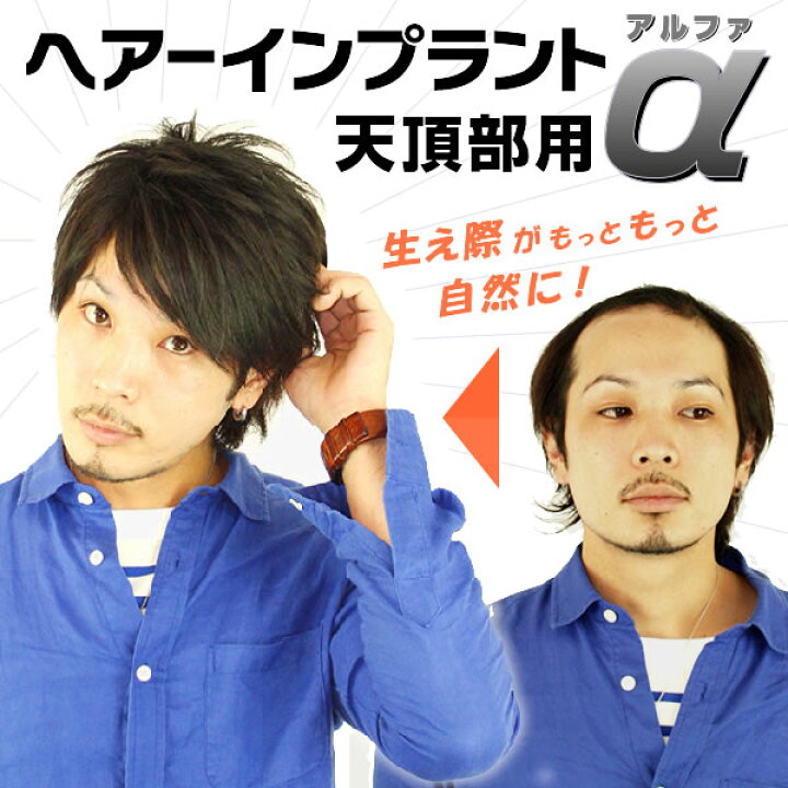 楽天市場】ヘアーインプラントEX 天頂部用α【アルファ】部分かつら 