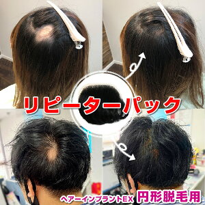 is[^[pbNjwA[CvgEX ~`EяǗpijɂ̓e[vVR̂Kvł