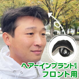 ヘアーインプラントEX フロント用(部分かつら)※装着には別途、強力テープかスーパーシリコンの購入が必要です 生え際　増毛　薄毛　剃りこみ　AGA　男性用　メンズウィッグ