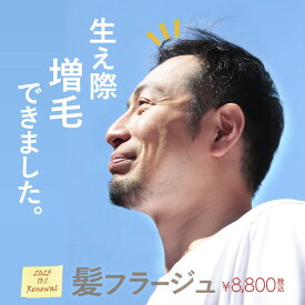 髪フラージュ　カミフラージュ　生え際増毛　貼るかつら　増毛シート　増毛パウダー　ミリオンヘアー