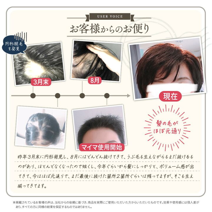 楽天市場 育毛剤 女性用 無添加 天然成分 妊娠 産後 Maima マイマ ベタつかない ヘアローション 100ml レディース 抜け毛 妊娠中 妊婦 頭皮 頭皮環境 地肌ケア 予防対策 薬用育毛剤 女性育毛剤 毛髪 毛髪活性 毛根 ママ 安心 薄毛 医薬部外品 妊娠 出産のママ 楽天市場 育毛剤 女性用 無添加 天然成分 妊娠 産後 Maima マイマ ベタつかない ヘアローション 100ml レディース 抜け毛 妊娠中 妊婦 頭皮 頭皮環境 地肌ケア 予防対策 薬用育毛剤 女性育毛剤 毛髪 毛髪活性 毛根 ママ 安心 薄毛 医薬部外品 妊娠 出産のママ
