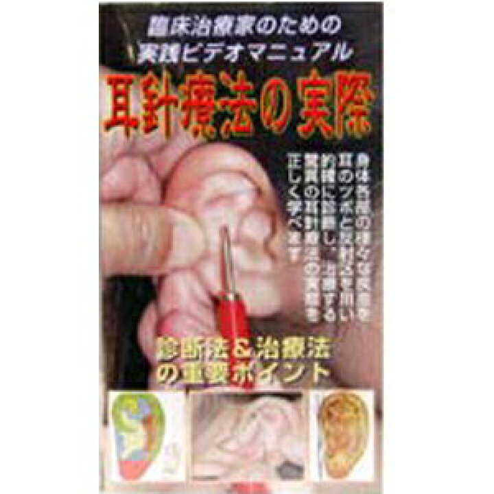 楽天市場】DVD・耳針療法の実際(じしんりょうほうのじっさい)(SR-454 