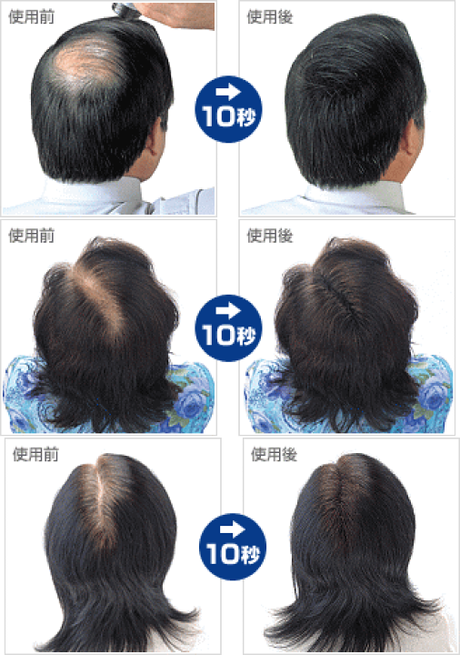 楽天市場】スーパーミリオンヘアー ミニセット(ブラック) : 愛らんど