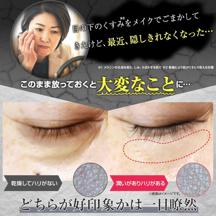 楽天市場】【アイクリーム】 ラップリフト リンクル 薬用 ナイアシン