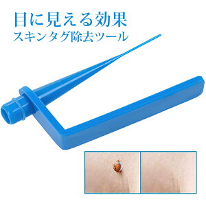 C{ XL^O[o[foCXLbgXL^Oق낢ڃ[o[pb`^^̃XL^Op̃XL^O[o[c[-SŒɂ݂̂ȂAX[YȌ