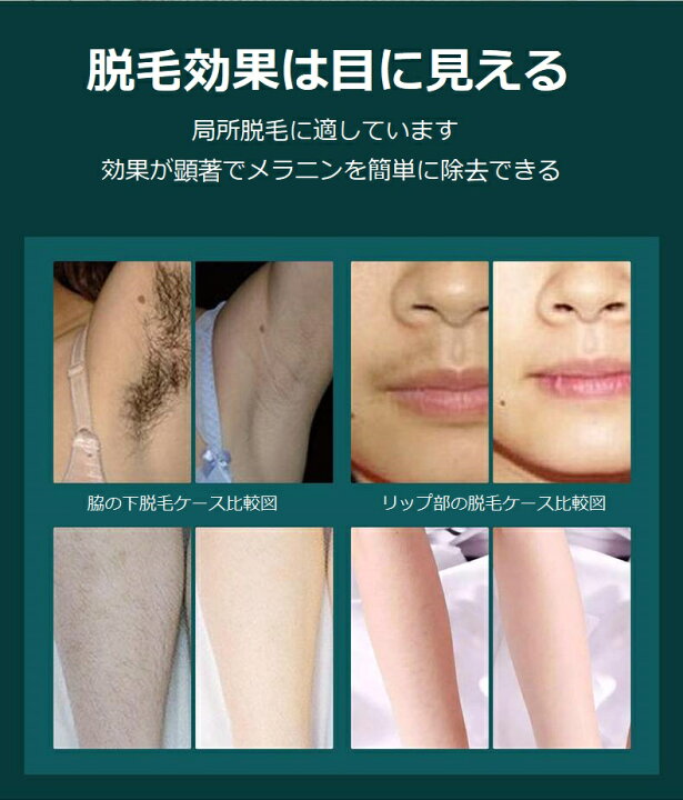レーザー脱毛器 Pr 脱毛器 美容機器 顔 背中 Ipl 足 脱毛機 Hair セルフ脱毛 腕 Laser 自宅 除毛 家庭用 脱毛 ムダ毛処理 脇 Plus 光 Removal レーザー脱毛器 Pr 脱毛器 美容機器 顔 背中 Ipl 足 脱毛機 Hair セルフ脱毛 腕 Laser 自宅 除毛 家庭用 脱毛 ムダ毛処理 脇 Plus 光 Removal