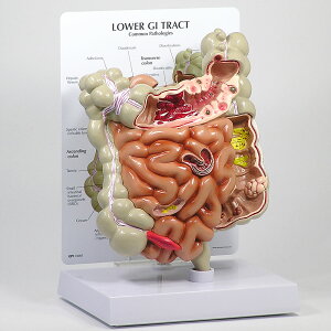 l̖͌^  咰  f OM-GP-3342 GPI Anatomicals N[a ᇐ咰 |[v   Ґ w wKp  