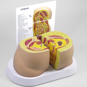 l̖͌^ 얞 ^Cv OM-GP-3600 GPI Anatomicals S^ miV^ b 牺b ^{ Ґ Ka w  