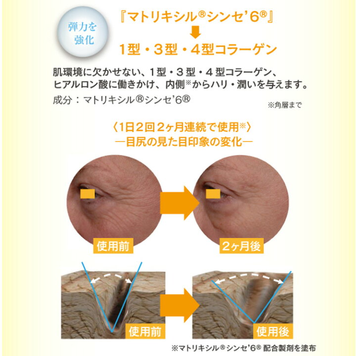 楽天市場 Special Sale 送料無料 アイリッチクリーム 15g アイクリーム 保湿 おうち美容 目元ケア アイケア ハリ 弾力 まぶた くま クマ スキンケア レチノール 高濃度 アルジルリン コラーゲン エイジングケア プレゼント 女性 妻 彼女 ギフト 日本ライフ製薬株式会社