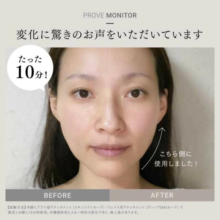 楽天市場】週末、祭日限定！トータルリフト美顔器 MYTREX PROVE マイ 