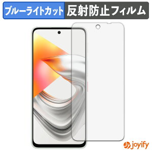 �y�|�C���g2�{�z �y �u���[���C�g�J�b�g �z�t�B���� ZTE nubia S2R / S2e �ی�t�B���� �A���`�O���A ���˖h�~ �ی� �u���[���C�g�J�b�g�t�B���� �w��h�~ �t���ی�t�B����