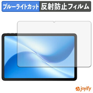 y u[CgJbg ztB DOOGEE U12 یtB A`OA ˖h~ ی u[CgJbgtB wh~ tیtB