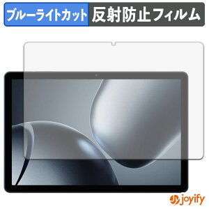 �y�|�C���g2�{�z �y �u���[���C�g�J�b�g �z�t�B���� KINGRID T90 �ی�t�B���� �A���`�O���A ���˖h�~ �ی� �u���[���C�g�J�b�g�t�B���� �w��h�~ �t���ی�t�B����