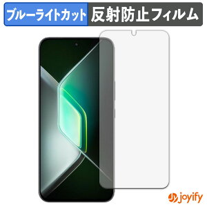 y u[CgJbg ztB Infinix GT 30 Pro یtB A`OA ˖h~ ی u[CgJbgtB wh~ tیtB