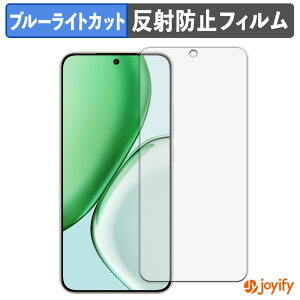 y|Cg2{z y u[CgJbg ztB HONOR X70 یtB A`OA ˖h~ ی u[CgJbgtB wh~ tیtB