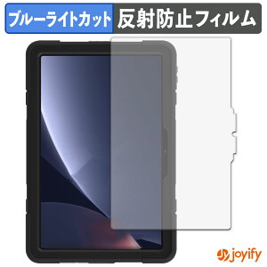 y u[CgJbg ztB AGM PAD P2 Active یtB A`OA ˖h~ ی u[CgJbgtB wh~ tیtB