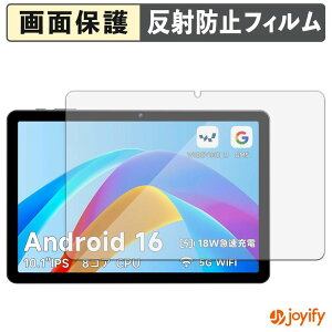 �y �A���`�O���A �z�t�B���� PHILIPS T7315X �ی�t�B���� �A���`�O���A ���˖h�~ �ی� �w��h�~ ��ʕی� �R�� �t���ی�t�B���� �V�[�g