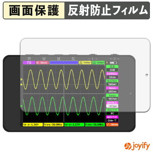 y A`OA ztB ALIENTEK DS100 IVXR[v یtB A`OA ˖h~ ی wh~ ʕی R tیtB V[g