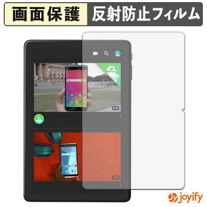 �y7/26 1:59�� �|�C���g2�{�z �y �A���`�O���A �z�t�B���� Callsky Cpad 10 �ی�t�B���� �A���`�O���A ���˖h�~ �ی� �w��h�~ ��ʕی� �R�� �t���ی�t�B���� �V�[�g