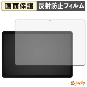 �y�|�C���g2�{�z �y �A���`�O���A �z�t�B���� Rebecco M30 �ی�t�B���� �A���`�O���A ���˖h�~ �ی� �w��h�~ ��ʕی� �R�� �t���ی�t�B���� �V�[�g