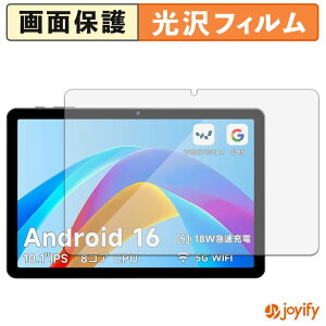 �y ���� �z�t�B���� PHILIPS T7315X �ی�t�B���� ���� �ی� ������ �w��h�~ ��ʕی� �R�� �t���ی�t�B����
