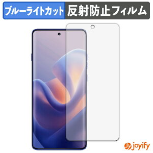 s|Cg2{t y TPU u[CgJbg ztB motorola edge 60 pro / 60s pro یtB Sʕی A`OA ˖h~ tیtB LYC