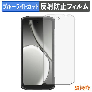�y�|�C���g2�{�z �y TPU �u���[���C�g�J�b�g �z�t�B���� DOOGEE Blade20 Play �ی�t�B���� �S�ʕی� �A���`�O���A ���˖h�~ �t���ی�t�B���� �L�Y�C��