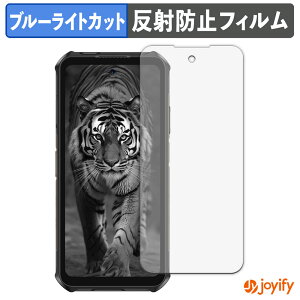 �y�|�C���g2�{�z �y TPU �u���[���C�g�J�b�g �z�t�B���� Ulefone Armor X16 �ی�t�B���� �S�ʕی� �A���`�O���A ���˖h�~ �t���ی�t�B���� �L�Y�C��