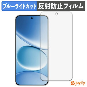 �y TPU �u���[���C�g�J�b�g �z�t�B���� Xiaomi REDMI Note 15 Pro �ی�t�B���� �S�ʕی� �A���`�O���A ���˖h�~ �t���ی�t�B���� �L�Y�C��