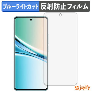 y TPU u[CgJbg ztB Xiaomi REDMI Note 15 یtB Sʕی A`OA ˖h~ tیtB LYC