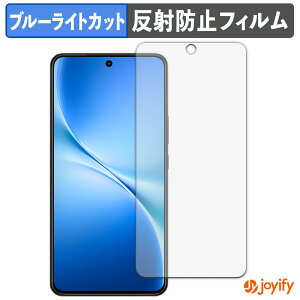 �y TPU �u���[���C�g�J�b�g �z�t�B���� vivo V60 Lite 5G �ی�t�B���� �S�ʕی� �A���`�O���A ���˖h�~ �t���ی�t�B���� �L�Y�C��