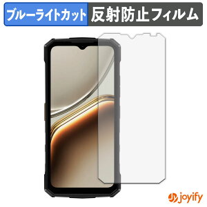 �y TPU �u���[���C�g�J�b�g �z�t�B���� DOOGEE Fire 5 �ی�t�B���� �S�ʕی� �A���`�O���A ���˖h�~ �t���ی�t�B���� �L�Y�C��