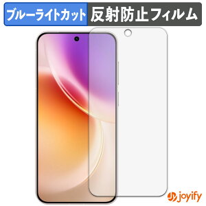 �y TPU �u���[���C�g�J�b�g �z�t�B���� vivo X300 �ی�t�B���� �S�ʕی� �A���`�O���A ���˖h�~ �t���ی�t�B���� �L�Y�C��