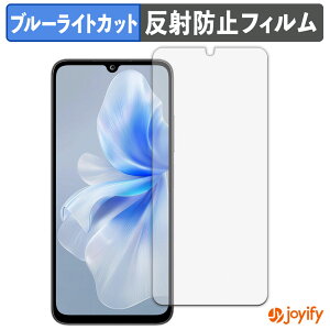 �y TPU �u���[���C�g�J�b�g �z�t�B���� FOSSiBOT S2 �ی�t�B���� �S�ʕی� �A���`�O���A ���˖h�~ �t���ی�t�B���� �L�Y�C��