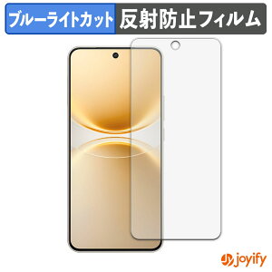 �y TPU �u���[���C�g�J�b�g �z�t�B���� vivo Y500 Pro �ی�t�B���� �S�ʕی� �A���`�O���A ���˖h�~ �t���ی�t�B���� �L�Y�C��