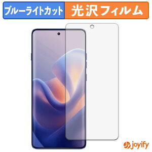 y TPU u[CgJbg ztB motorola edge 60 pro / 60s pro یtB Sʕی  ʕی tی LYC