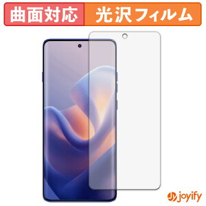 y TPU ztB motorola edge 60 pro / 60s pro یtB Sʕی  ی  ʕی tیtB LYC