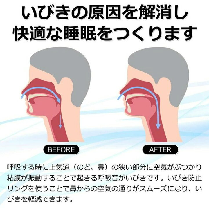 楽天市場】いびき防止 リング いびき いびき対策 睡眠グッズ 指輪 いびき+リング イビキ 防止 いびき防止グッズ イビキ防止グッズ 睡眠グッズ 鼻 いびき防止グッズいびき防止テープ 睡眠サプリ 安眠 母の日 父の日【送料無料】 : 東京セレクト 楽天市場】いびき防止 リング いびき いびき対策 睡眠グッズ 指輪 いびき+リング イビキ 防止 いびき防止グッズ イビキ防止グッズ 睡眠グッズ 鼻 いびき防止グッズいびき防止テープ 睡眠サプリ 安眠 母の日 父の日【送料無料】 : 東京セレクト